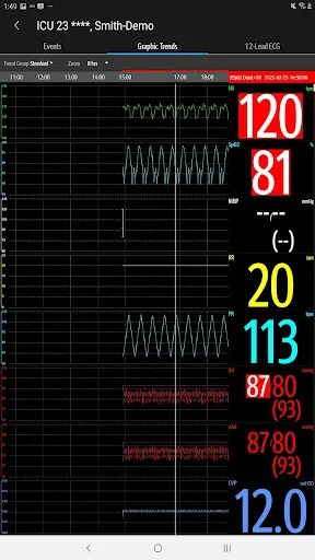 Mindray Mobile Viewer ডাউনলোড করুন – রিয়েল-টাইম পেশেন্ট মনিটরিং - Screenshot 15
